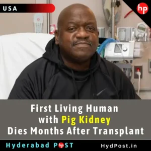 Read more about the article First Living Human with Pig Kidney Dies Months After Transplant
